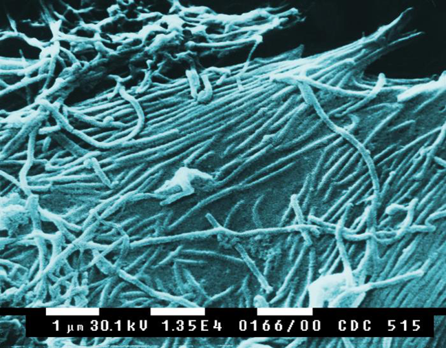Virions d'Ebola au microscope électronique (Crédits Charting the Path of the Deadly Ebola Virus in Central Africa. PLoS Biol 3 11 2005 e403 doi 10.1371 journal.pbio.0030403, licence Creative Commons)