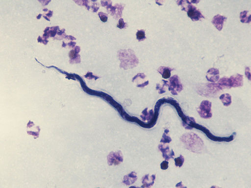 Loa microfilaria - crédits Stefan Walkowski - licence Creative Commons (CC BY-SA 3.0)