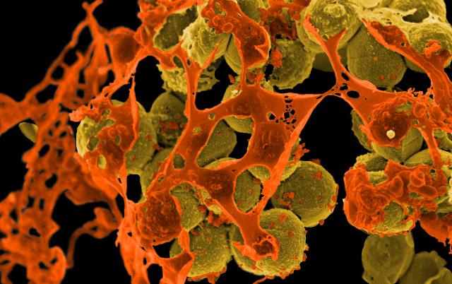 NIAID-methicillin-resistant staphylococcus aureus(CC BY 2.0)