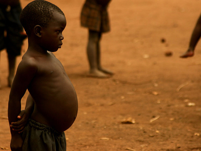 Autoriser le riz doré aiderait à lutter contre la malnutrition Autoriser le riz doré aiderait à lutter contre la malnutrition