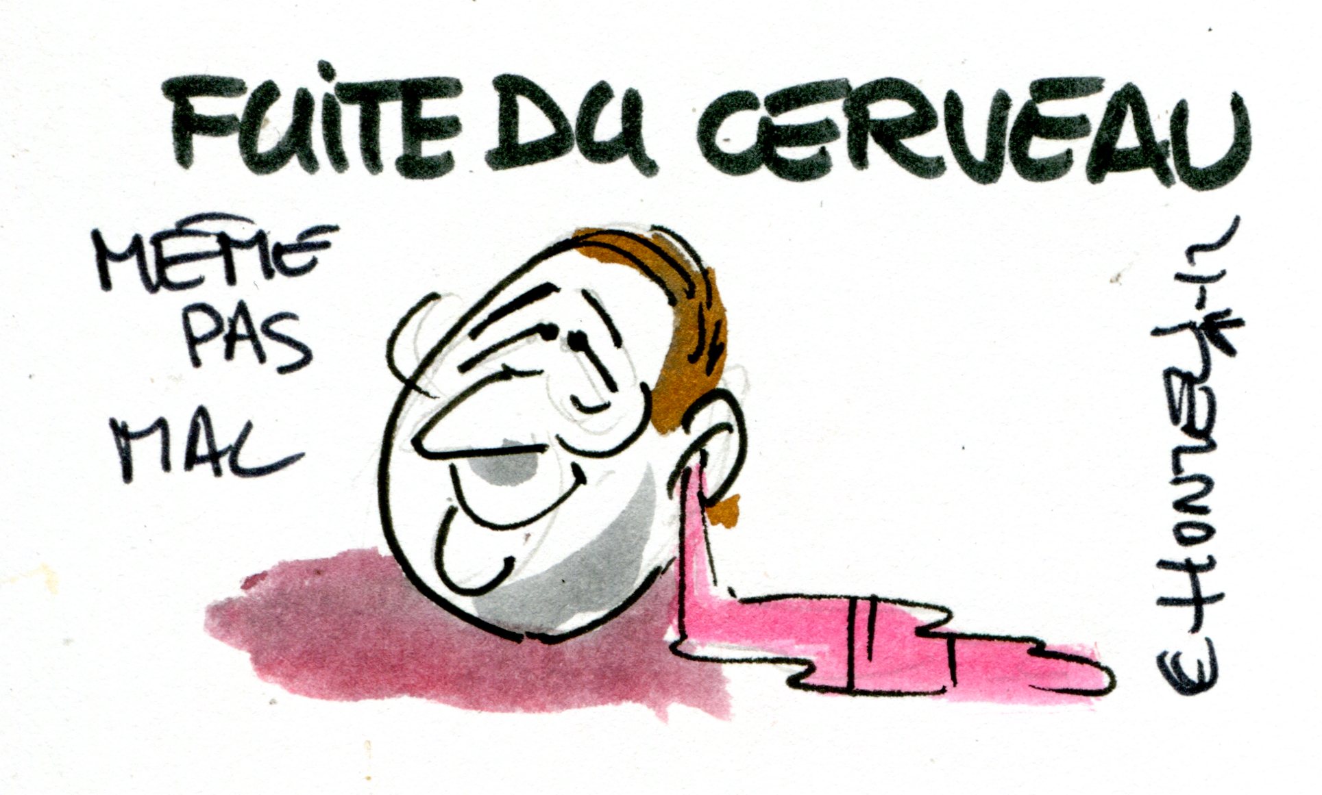 Fuite De Cerveau Contrepoints