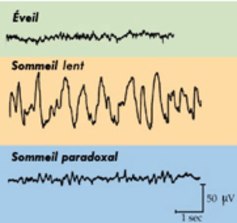 Le sommeil profond (ou lent) se caractérise par un électroencéphalogramme montrant des ondes de grande amplitude, ce qui signifie que localement, tous les neurones sont en phase.